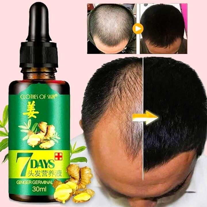 King of Ginger Hair Serum Karachi 30ml for Hair Growth