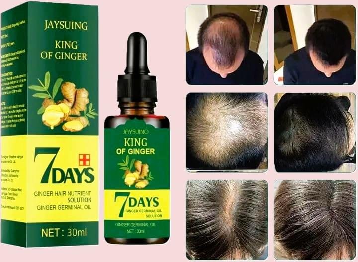 King of Ginger Hair Serum Karachi 30ml for Hair Growth